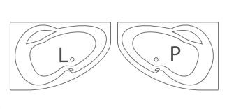 Kád, Roltechnik Harmonia 160x95 aszimmetrikus sarok : RT